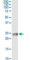 Anti-CLDN4 Mouse Monoclonal Antibody [clone: 4A11]