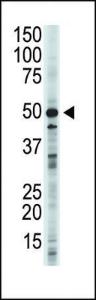 Anti-GSK3B Rabbit Polyclonal Antibody (APC (Allophycocyanin))