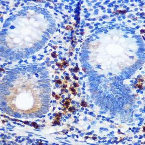 Immunohistochemistry analysis of paraffin-embedded human appendix tissue using Anti-CD41 Antibody [ARC0620] (A81216) at a dilution of 1:100 (40X lens). Perform microwave antigen retrieval with 10 mM PBS buffer pH 7.2 before commencing with IHC staining protocol