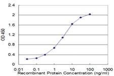 Anti-RP2 Mouse Monoclonal Antibody [clone: 1B4]