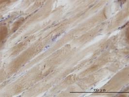 Anti-SH3BGR Mouse Monoclonal Antibody [clone: 3B7]