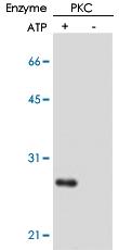 Anti-PPP1R14A Mouse Monoclonal Antibody [clone: AK-1F11]