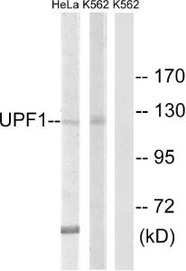 Western blot analysis of lysates from K562 and HeLa cells using Anti-UPF1 Antibody. The right hand lane represents a negative control, where the antibody is blocked by the immunising peptide