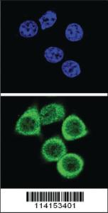 Anti-PARP1 Rabbit Polyclonal Antibody