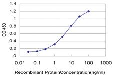 Anti-RCVRN Mouse Monoclonal Antibody [clone: 4D9]