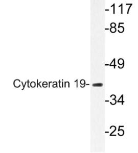 Anti-Cytokeratin&nbsp;19 antibody