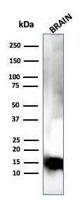 Western blot analysis of human brain tissue lysate using Anti-Myelin Basic Protein Antibody [MBP/4275]