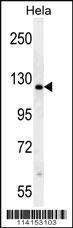 Anti-PARP1 Rabbit Polyclonal Antibody