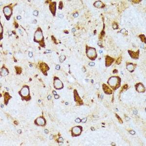 Immunohistochemistry analysis of paraffin-embedded rat brain using Anti-alpha COP I/COPA Antibody [ARC2215] (A307527) at a dilution of 1:100(40X lens). Perform microwave antigen retrieval with 10 mM Tris/EDTA buffer pH 9.0 before commencing with IHC staining protocol