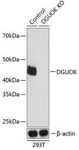 Western blot analysis of extracts from normal (control) and DGUOK knockout (KO) 293T cells, using Anti-dGK Antibody (A308489) at 1:1,000 dilution. The secondary antibody was Goat Anti-Rabbit IgG H&L Antibody (HRP) at 1:10,000 dilution.