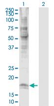 Anti-CLDN7 Rabbit Polyclonal Antibody