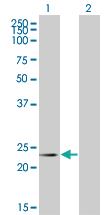 Anti-RCVRN Mouse Monoclonal Antibody [clone: 4C10]