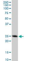 Anti-FAM3C Mouse Monoclonal Antibody [clone: 3A3]