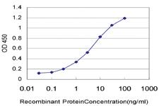 Anti-RCVRN Mouse Monoclonal Antibody [clone: 4C10]