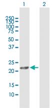 Anti-DHRS11 Rabbit Polyclonal Antibody