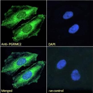 Anti-PGRMC2 Antibody (A121176) - Immunofluorescence analysis of paraformaldehyde fixed HeLa cells, permeabilized with 0