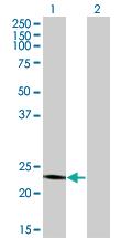 Anti-RCVRN Mouse Monoclonal Antibody [clone: 4E2]