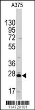 Anti-MAP3K6 Rabbit Polyclonal Antibody