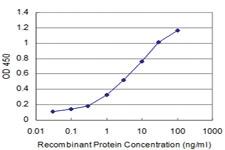 Anti-RCVRN Mouse Monoclonal Antibody [clone: 4E2]