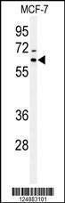 Anti-IRGQ Rabbit Polyclonal Antibody (HRP (Horseradish Peroxidase))