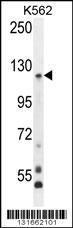 Anti-PCDHGA8 Rabbit Polyclonal Antibody (AP (Alkaline Phosphatase))