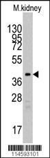 Anti-TBRG1 Rabbit Polyclonal Antibody