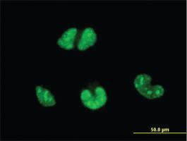 Anti-ESR2 Mouse Monoclonal Antibody [clone: 3F3]