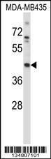 Anti-MAP2K1 Rabbit Polyclonal Antibody (APC (Allophycocyanin))