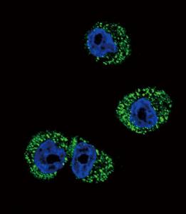 Anti-CCR7 Rabbit Polyclonal Antibody (FITC (Fluorescein Isothiocyanate))