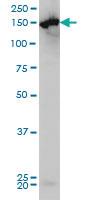 Anti-CPS1 Mouse Monoclonal Antibody [clone: 8H8]