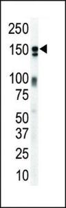 Anti-ERBB3 Rabbit Polyclonal Antibody (FITC (Fluorescein))