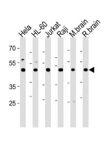 Anti-CTBP1 Rabbit Polyclonal Antibody (FITC (Fluorescein Isothiocyanate))