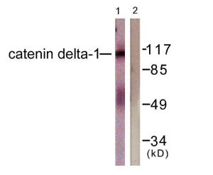 Western blot analysis of lysates from HUVEC cells using Anti-Catenin-delta1 Antibody. The right hand lane represents a negative control, where the antibody is blocked by the immunising peptide