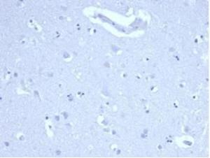 Anti-Ki67 Rabbit Recombinant Antibody [Clone: MKI67/4947R]