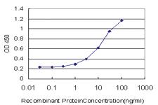 Anti-ESR2 Mouse Monoclonal Antibody [clone: 3F3]