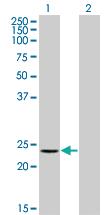 Anti-RCVRN Mouse Monoclonal Antibody [clone: 2B3]