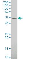 Anti-CRELD2 Mouse Polyclonal Antibody