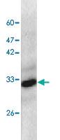 Anti-RPSA Mouse Monoclonal Antibody [clone: 16]