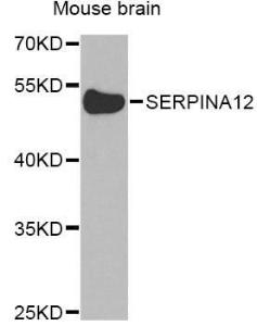 Western blot analysis of extracts of mouse brain, using Anti-SERPINA12 Antibody (A8074) at 1:1,000 dilution