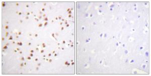 Immunohistochemical analysis of paraffin-embedded human brain tissue using Anti-Catenin-delta1 Antibody. The right hand panel represents a negative control, where the antibody was pre-incubated with the immunising peptide