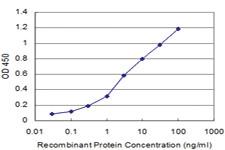 Anti-RCVRN Mouse Monoclonal Antibody [clone: 2B3]