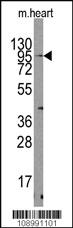 Anti-PAX1 Rabbit Polyclonal Antibody