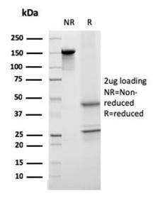 SDS-PAGE analysis of Anti-Transferrin Antibody [TF/3001] under non-reduced and reduced conditions; showing intact IgG and intact heavy and light chains, respectively. SDS-PAGE analysis confirms the integrity and purity of the antibody