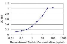 Anti-RCVRN Mouse Monoclonal Antibody [clone: 2B2]