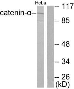 Western blot analysis of lysates from HeLa cells using Anti-Catenin-alpha1 Antibody. The right hand lane represents a negative control, where the antibody is blocked by the immunising peptide