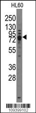 Anti-TRPV3 Rabbit Polyclonal Antibody