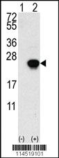 Anti-FGF1 Rabbit Polyclonal Antibody