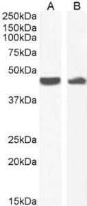 Anti-alpha smooth muscle actin antibody