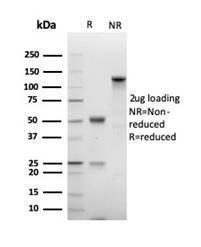 Anti-Ki67 Rabbit Recombinant Antibody [Clone: MKI67/4947R]