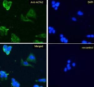 Anti-alpha smooth muscle actin antibody